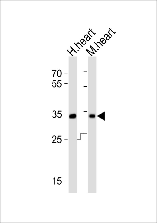 ASB11 Antibody - Western blot of lysates from human heart, mouse heart tissue (from left to right), using ASB11 Antibody. Antibody was diluted at 1:1000 at each lane. A goat anti-rabbit IgG H&L (HRP) at 1:10000 dilution was used as the secondary antibody. Lysates at 20ug per lane.