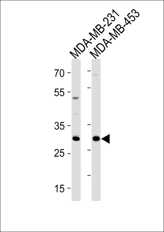 ASB11 Antibody - ASB11 Antibody western blot of MDA-MB-231,MDA-MB-453 cell line lysates (35 ug/lane). The ASB11 antibody detected the ASB11 protein (arrow).