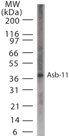 ASB11 Antibody - Western blot of Asb-11 in 15 ugs of human liver cell lysate using antibody at 1:1000 dilution.