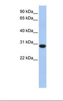 ASB12 Antibody - Fetal muscle lysate. Antibody concentration: 1.0 ug/ml. Gel concentration: 12%.  This image was taken for the unconjugated form of this product. Other forms have not been tested.