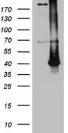 ASB13 Antibody - HEK293T cells were transfected with the pCMV6-ENTRY control. (Left lane) or pCMV6-ENTRY ASB13. (Right lane) cDNA for 48 hrs and lysed. Equivalent amounts of cell lysates. (5 ug per lane) were separated by SDS-PAGE and immunoblotted with anti-ASB13. (1:2000)