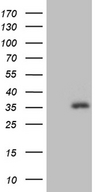 ASB13 Antibody - HEK293T cells were transfected with the pCMV6-ENTRY control. (Left lane) or pCMV6-ENTRY ASB13. (Right lane) cDNA for 48 hrs and lysed. Equivalent amounts of cell lysates. (5 ug per lane) were separated by SDS-PAGE and immunoblotted with anti-ASB13. (1:500)