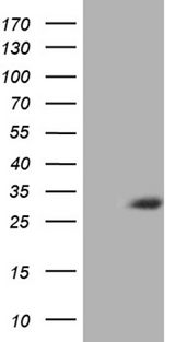 ASB13 Antibody - HEK293T cells were transfected with the pCMV6-ENTRY control. (Left lane) or pCMV6-ENTRY ASB13. (Right lane) cDNA for 48 hrs and lysed