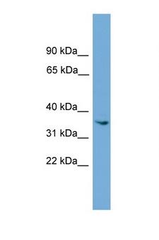 ASB17 Antibody - ASB17 antibody Western blot of ACHN Cell lysate. Antibody concentration 1 ug/ml. This image was taken for the unconjugated form of this product. Other forms have not been tested.