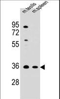 ASB17 Antibody - ASB17 Antibody western blot of mouse testis,spleen tissue lysates (35 ug/lane). The ASB17 antibody detected the ASB17 protein (arrow).