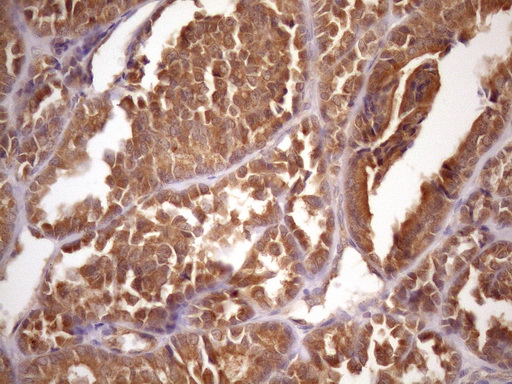 ASB2 Antibody - IHC of paraffin-embedded Human thyroid tissue using anti-ASB2 mouse monoclonal antibody. (Heat-induced epitope retrieval by Tris-EDTA, pH8.0)(1:150).