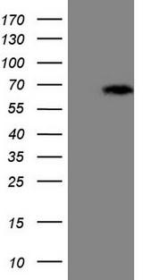 ASB2 Antibody - HEK293T cells were transfected with the pCMV6-ENTRY control. (Left lane) or pCMV6-ENTRY ASB2. (Right lane) cDNA for 48 hrs and lysed. Equivalent amounts of cell lysates. (5 ug per lane) were separated by SDS-PAGE and immunoblotted with anti-ASB2. (1:500)
