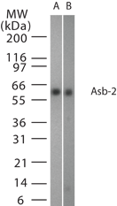 ASB2 Antibody - Western blot of Asb-2 using antibody at 1:1000 dilution against 15 ug/lane of human spleen lysate (lane 1) and lung lysate (lane 2).