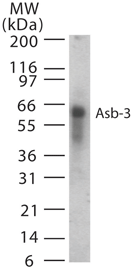 ASB3 Antibody - Western blot of Asb-3 in 15 ugs of human spleen cell lysate using antibody at 1:1000 dilution.
