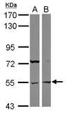 ASB3 Antibody - Sample (30 ug of whole cell lysate) A: 293T B: Raji 7.5% SDS PAGE ASB3 antibody diluted at 1:1000