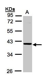 ASB4 Antibody - Sample (30g whole cell lysate). A: A431. 10% SDS PAGE. ASB4 antibody diluted at 1:1000