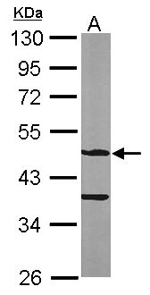 ASB4 Antibody - Sample (50 ug of whole cell lysate). A: Mouse brain. 10% SDS PAGE. ASB4 antibody diluted at 1:1000.