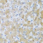 ASB4 Antibody - Immunohistochemistry of paraffin-embedded Human liver using ASB4 Polyclonal Antibody at dilution of 1:100 (40x lens).