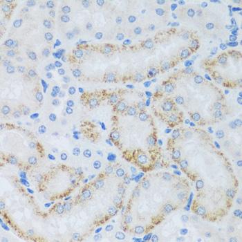 ASB4 Antibody - Immunohistochemistry of paraffin-embedded Mouse kidney using ASB4 Polyclonal Antibody at dilution of 1:100 (40x lens).