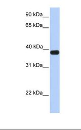 ASB5 Antibody - Fetal muscle lysate. Antibody concentration: 1.0 ug/ml. Gel concentration: 12%.  This image was taken for the unconjugated form of this product. Other forms have not been tested.