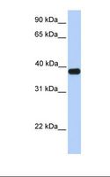 ASB5 Antibody - Fetal muscle lysate. Antibody concentration: 1.0 ug/ml. Gel concentration: 12%.  This image was taken for the unconjugated form of this product. Other forms have not been tested.