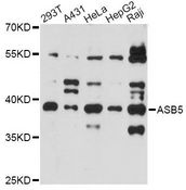 ASB5 Antibody - Western blot analysis of extracts of various cell lines, using ASB5 antibody at 1:3000 dilution. The secondary antibody used was an HRP Goat Anti-Rabbit IgG (H+L) at 1:10000 dilution. Lysates were loaded 25ug per lane and 3% nonfat dry milk in TBST was used for blocking. An ECL Kit was used for detection and the exposure time was 90s.