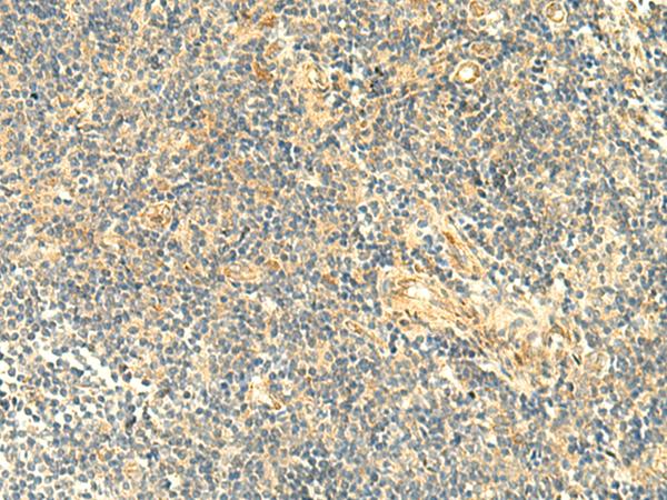 ASB6 Antibody - Immunohistochemistry of paraffin-embedded Human tonsil tissue  using ASB6 Polyclonal Antibody at dilution of 1:50(×200)