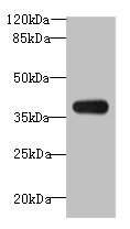 ASB7 Antibody - Western blot All lanes: ASB7 antibody at 8µg/ml + A431 whole cell lysate Secondary Goat polyclonal to rabbit IgG at 1/10000 dilution Predicted band size: 37, 31 kDa Observed band size: 37 kDa