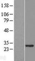 ASB7 Protein - Western validation with an anti-DDK antibody * L: Control HEK293 lysate R: Over-expression lysate