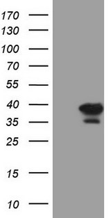 ASB8 Antibody - HEK293T cells were transfected with the pCMV6-ENTRY control. (Left lane) or pCMV6-ENTRY ASB8. (Right lane) cDNA for 48 hrs and lysed. Equivalent amounts of cell lysates. (5 ug per lane) were separated by SDS-PAGE and immunoblotted with anti-ASB8. (1:2000)