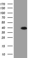 ASB8 Antibody - HEK293T cells were transfected with the pCMV6-ENTRY control. (Left lane) or pCMV6-ENTRY ASB8. (Right lane) cDNA for 48 hrs and lysed. Equivalent amounts of cell lysates. (5 ug per lane) were separated by SDS-PAGE and immunoblotted with anti-ASB8. (1:2000)