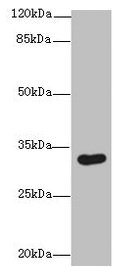 ASB8 Antibody - Western blot All lanes: ASB8 antibody at 1µg/ml + Human placenta tissue Secondary Goat polyclonal to rabbit IgG at 1/10000 dilution Predicted band size: 32 kDa Observed band size: 32 kDa