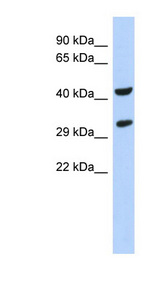 ASB8 Antibody - ASB8 antibody Western blot of Fetal Pancreas lysate. This image was taken for the unconjugated form of this product. Other forms have not been tested.