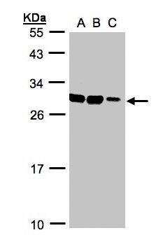 ASB9 Antibody - Sample (30 ug whole cell lysate). A: HeLa S3, B: Hep G2 , C: MOLT4 . 12% SDS PAGE. ASB9 antibody diluted at 1:1000