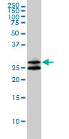 ASB9 Antibody - ASB9 monoclonal antibody (M01), clone 1D8 Western blot of ASB9 expression in HepG2.
