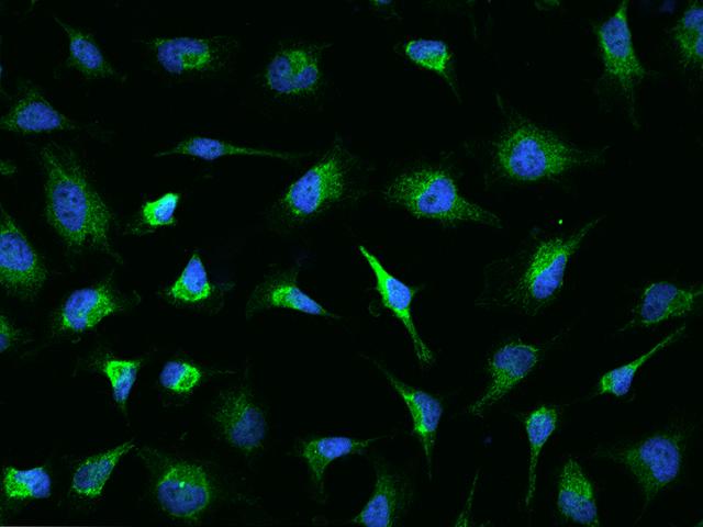 ASB9 Antibody - Immunofluorescence staining of ASB9 in Hela cells. Cells were fixed with 4% PFA, permeabilzed with 0.1% Triton X-100 in PBS, blocked with 10% serum, and incubated with rabbit anti-Human ASB9 polyclonal antibody (dilution ratio 1:200) at 4°C overnight. Then cells were stained with the Alexa Fluor 488-conjugated Goat Anti-rabbit IgG secondary antibody (green) and counterstained with DAPI (blue). Positive staining was localized to Cytoplasm.