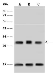 ASB9 Antibody - Anti-ASB9 rabbit polyclonal antibody at 1:500 dilution. Lane A: U-251 MG Whole Cell Lysate. Lane B: HepG2 Whole Cell Lysate. Lane C: MOLT4 Whole Cell Lysate. Lysates/proteins at 30 ug per lane. Secondary: Goat Anti-Rabbit IgG (H+L)/HRP at 1/10000 dilution. Developed using the ECL technique. Performed under reducing conditions. Predicted band size: 32 kDa. Observed band size: 32 kDa. (We are unsure as to the identity of these extra bands.)