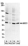 ASCC1 Antibody - Detection of Human ASCC1 by Western Blot. Samples: Whole cell lysate from HeLa (15 and 50 ug), 293T (50 ug), and Jurkat (50 ug) cells. Antibodies: Affinity purified rabbit anti-ASCC1 antibody used for WB at 0.4 ug/ml. Detection: Chemiluminescence with an exposure time of 3 minutes.