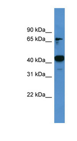 ASCC1 Antibody - ASCC1 antibody Western blot of Rat Muscle lysate. This image was taken for the unconjugated form of this product. Other forms have not been tested.