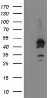 ASCC1 Antibody - HEK293T cells were transfected with the pCMV6-ENTRY control (Left lane) or pCMV6-ENTRY ASCC1 (Right lane) cDNA for 48 hrs and lysed. Equivalent amounts of cell lysates (5 ug per lane) were separated by SDS-PAGE and immunoblotted with anti-ASCC1.