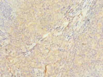 ASCC1 Antibody - Immunohistochemistry of paraffin-embedded human tonsil using antibody at dilution of 1:100.