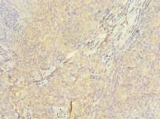 ASCC1 Antibody - Immunohistochemistry of paraffin-embedded human tonsil using antibody at dilution of 1:100.