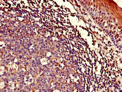 ASCC1 Antibody - Immunohistochemistry of paraffin-embedded human tonsil tissue using ASCC1 Antibody at dilution of 1:100