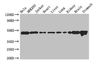 ASCC1 Antibody - Western Blot Positive WB detected in: Hela whole cell lysate, HEK293 whole cell lysate, Jurkat whole cell lysate, Mouse heart tissue, Mouse liver tissue, Mouse lung tissue, Mouse kidney tissue, Mouse brain tissue, Mouse stomach tissue All lanes: ASCC1 antibody at 2.7µg/ml Secondary Goat polyclonal to rabbit IgG at 1/50000 dilution Predicted band size: 46, 42 kDa Observed band size: 46 kDa