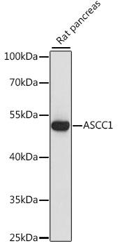 ASCC1 Antibody - Western blot analysis of extracts of rat pancreas using ASCC1 Polyclonal Antibody at dilution of 1:1000.