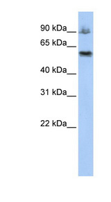 ASCC2 Antibody - ASCC2 antibody Western blot of HepG2 cell lysate. This image was taken for the unconjugated form of this product. Other forms have not been tested.