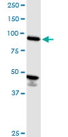 ASCC2 Antibody - ASCC2 monoclonal antibody (M07), clone 3B2. Western blot of ASCC2 expression in HeLa.