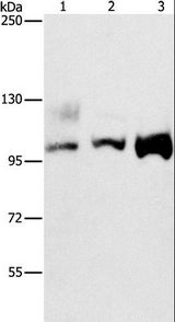 ASCC2 Antibody - Western blot analysis of A431, 293T and HeLa cell, using ASCC2 Polyclonal Antibody at dilution of 1:500.