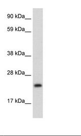 ASCL1 / MASH1 Antibody - Fetal Thymus Lysate.  This image was taken for the unconjugated form of this product. Other forms have not been tested.