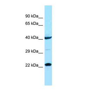 ASCL1 / MASH1 Antibody - Western blot of Human COLO205. ASCL1 antibody dilution 1.0 ug/ml.  This image was taken for the unconjugated form of this product. Other forms have not been tested.