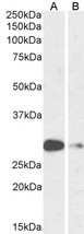 ASCL1 / MASH1 Antibody - Goat anti-ASCL1 (aa79-91) Antibody (1µg/ml) staining of Mouse (A) and Rat (B) Lung lysate (35µg protein in RIPA buffer). Primary incubation was 1 hour. Detected by chemiluminescencence
