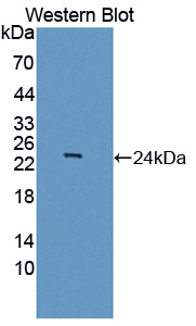 ASCL1 / MASH1 Antibody - Western blot of ASCL1 / MASH1 antibody.