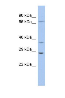 ASCL1 / MASH1 Antibody - ASCL1 / MASH1 antibody Western blot of 3 Cell lysate. Antibody concentration 1 ug/ml. This image was taken for the unconjugated form of this product. Other forms have not been tested.