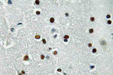 ASCL1 / MASH1 Antibody - IHC of ASCL1 (E158) pAb in paraffin-embedded human brain tissue.