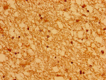 ASCL1 / MASH1 Antibody - Immunohistochemistry image of paraffin-embedded human brain tissue at a dilution of 1:100